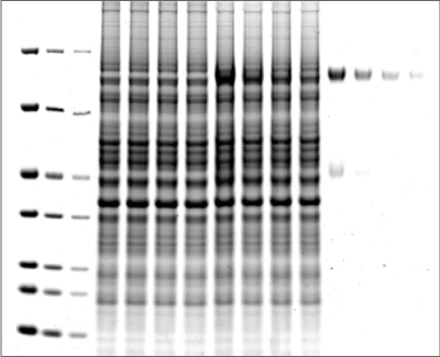 Figure 1: Coomassie Blue